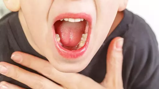 Nhức nhối vì đau rát lưỡi: Nguyên nhân và cách điều trị hiệu quả